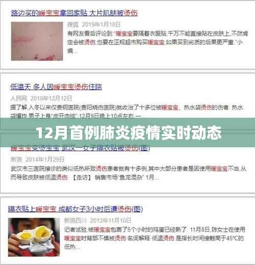 肺炎疫情实时动态,关注十二月首例病例